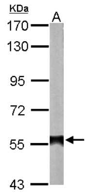 Western Blot: ALDH2 Antibody [NBP1-31749]