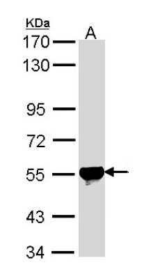 Western Blot: ALDH2 Antibody [NBP1-31749]