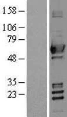 Western Blot: ALDH2 Overexpression Lysate [NBL1-07454]
