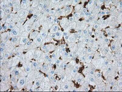 Immunohistochemistry-Paraffin: Aldehyde Dehydrogenase 3-A1/ALDH3A1 Antibody (OTI1B6) [NBP2-02483]