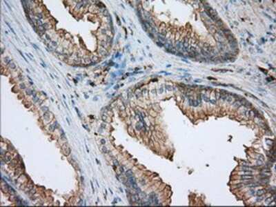 Immunohistochemistry-Paraffin: Aldehyde Dehydrogenase 3-A1/ALDH3A1 Antibody (OTI1B6) [NBP2-02483]