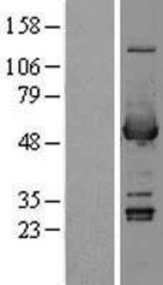 Western Blot: Aldehyde Dehydrogenase 3-A1/ALDH3A1 Overexpression Lysate [NBL1-07455]
