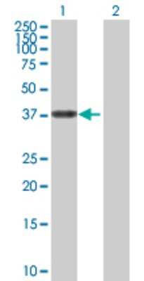 Western Blot: ALDH3B2 Antibody [H00000222-D01P]