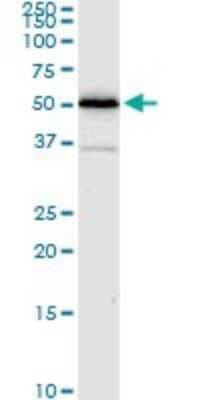 Western Blot: ALDH4A1 Antibody (1A12-A5) [H00008659-M01]