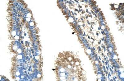 Immunohistochemistry-Paraffin: ALDH4A1 Antibody [NBP1-54739]