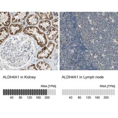 Immunohistochemistry-Paraffin: ALDH4A1 Antibody [NBP1-89149]