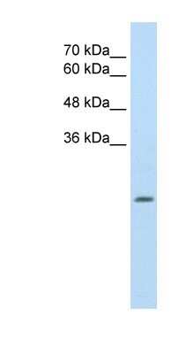 Western Blot: ALDH4A1 Antibody [NBP1-54739]