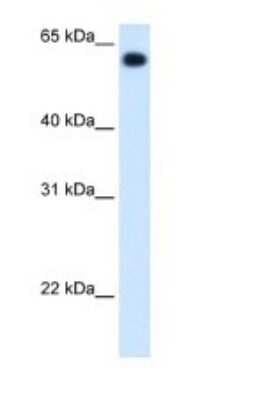 Western Blot: ALDH4A1 Antibody [NBP1-54740]