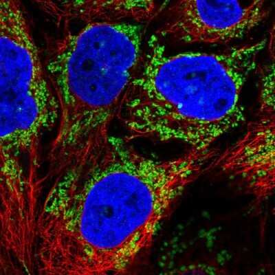 Immunocytochemistry/ Immunofluorescence: ALDH5A1 Antibody [NBP1-86996]