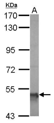 Western Blot: ALDH5A1 Antibody [NBP1-32970]