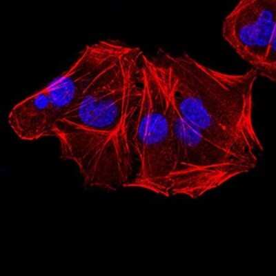Immunocytochemistry/ Immunofluorescence: ALDH6A1 Antibody (6H9B7) - BSA Free [NBP2-52411]