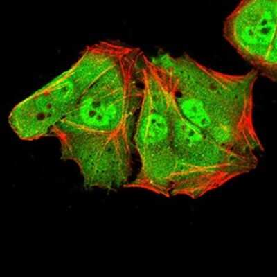 Immunocytochemistry/ Immunofluorescence: ALDH6A1 Antibody (6H9B7) - BSA Free [NBP2-52411]