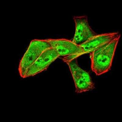 Immunocytochemistry/ Immunofluorescence: ALDH6A1 Antibody (6H9B8) - BSA Free [NBP2-52410]