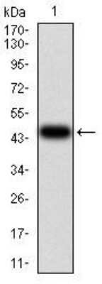 Western Blot: ALDH6A1 Antibody (6H9B8)BSA Free [NBP2-52410]