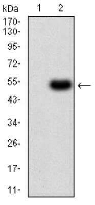 Western Blot: ALDH6A1 Antibody (6H9B8)BSA Free [NBP2-52410]