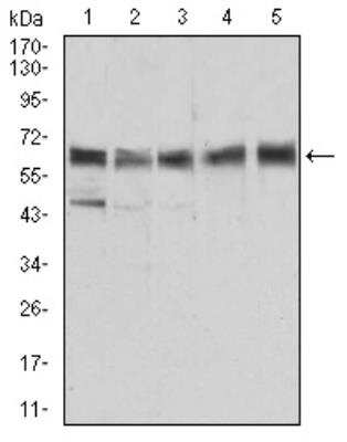 Western Blot: ALDH6A1 Antibody (6H9B8)BSA Free [NBP2-52410]