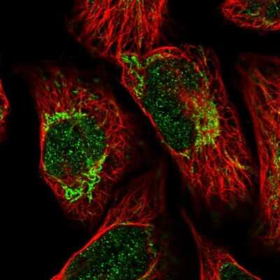 Immunocytochemistry/ Immunofluorescence: ALDH6A1 Antibody [NBP1-82635]