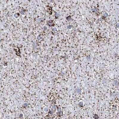 Immunohistochemistry-Paraffin: ALDH6A1 Antibody [NBP1-82635]