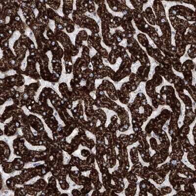 Immunohistochemistry-Paraffin: ALDH6A1 Antibody [NBP1-82636]