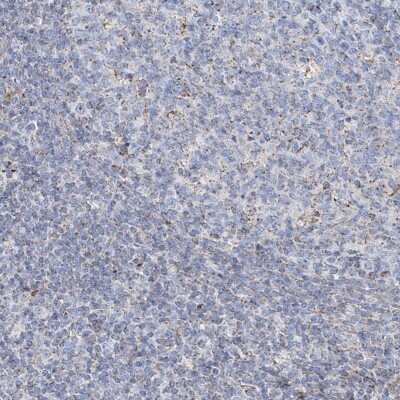 Immunohistochemistry-Paraffin: ALDH6A1 Antibody [NBP1-82637]