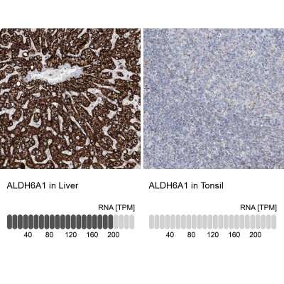 Immunohistochemistry-Paraffin: ALDH6A1 Antibody [NBP1-82637]