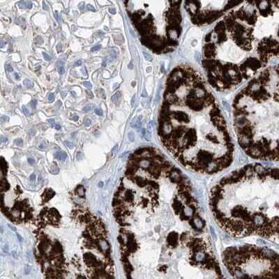 Immunohistochemistry-Paraffin: ALDH6A1 Antibody [NBP1-82637]