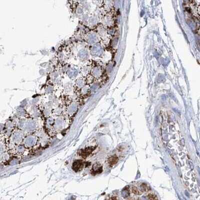 Immunohistochemistry-Paraffin: ALDH6A1 Antibody [NBP1-82637]