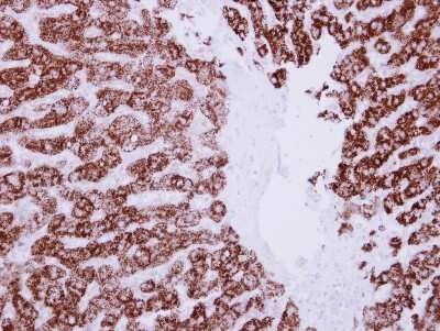 Immunohistochemistry-Paraffin: ALDH6A1 Antibody [NBP2-15341]