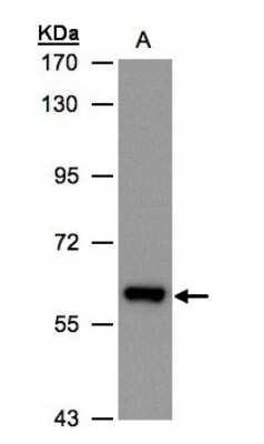 Western Blot: ALDH6A1 Antibody [NBP1-32381]
