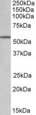Western Blot: ALDH6A1 Antibody [NBP1-52101]