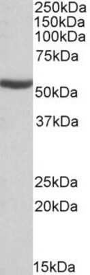 Western Blot: ALDH6A1 Antibody [NBP1-52102]