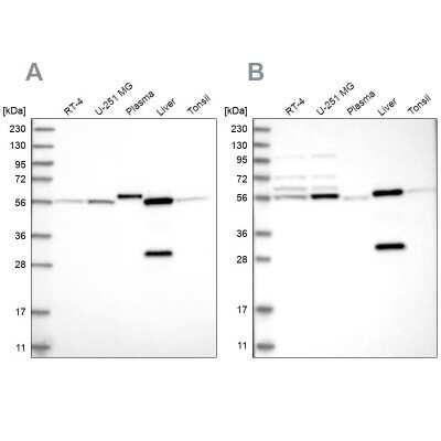 Western Blot: ALDH6A1 Antibody [NBP1-82634]