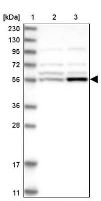 Western Blot: ALDH6A1 Antibody [NBP1-82635]