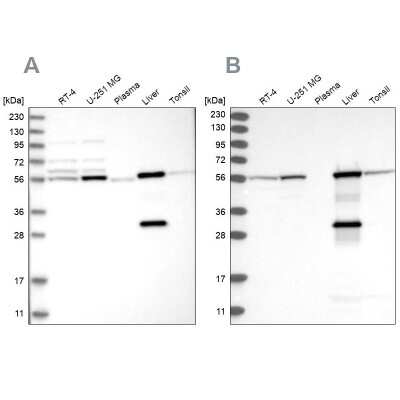 Western Blot: ALDH6A1 Antibody [NBP1-82635]