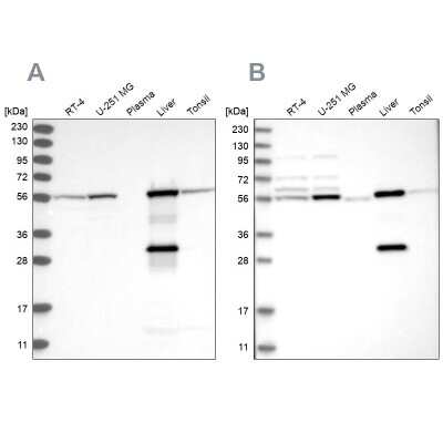 Western Blot: ALDH6A1 Antibody [NBP1-82636]