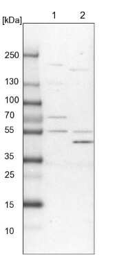 Western Blot: ALDH6A1 Antibody [NBP1-82637]
