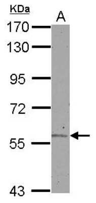 Western Blot: ALDH6A1 Antibody [NBP2-15341]