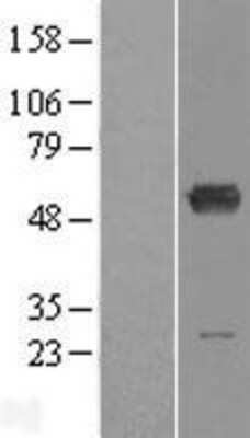 Western Blot: ALDH6A1 Overexpression Lysate [NBL1-07457]
