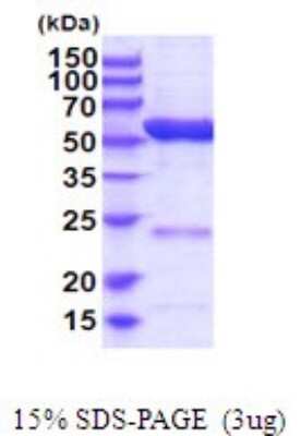 SDS-PAGE: Recombinant Human ALDH6A1 His Protein [NBP2-52090]
