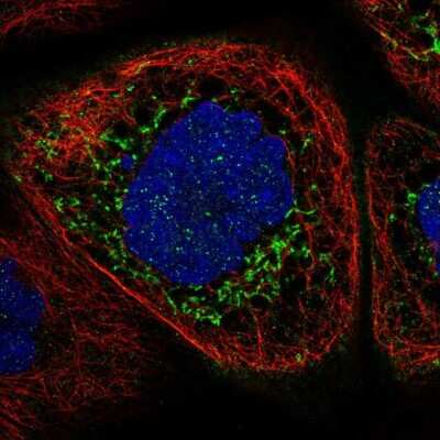 Immunocytochemistry/ Immunofluorescence: ALDH7A1 Antibody [NBP1-88908]