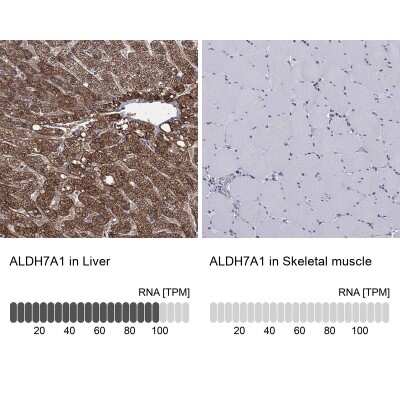 Immunohistochemistry-Paraffin: ALDH7A1 Antibody [NBP3-17010]
