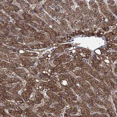 Immunohistochemistry-Paraffin: ALDH7A1 Antibody [NBP3-17010]