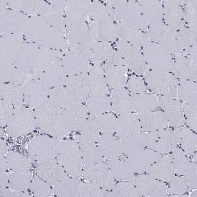 Immunohistochemistry-Paraffin: ALDH7A1 Antibody [NBP3-17010]