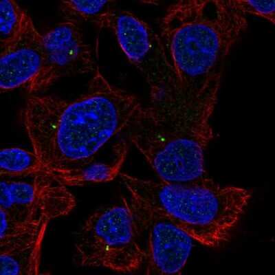 Immunocytochemistry/ Immunofluorescence: ALDH8A1 Antibody [NBP2-38753]