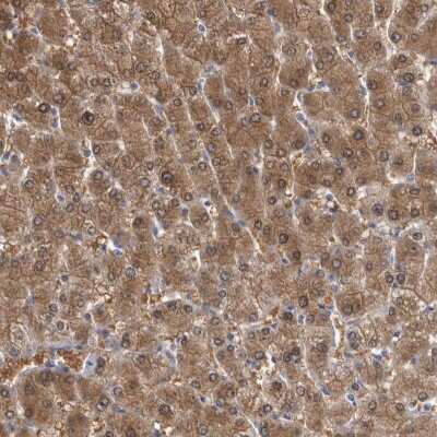 Immunohistochemistry-Paraffin: ALDH8A1 Antibody [NBP1-89151]