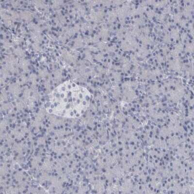 Immunohistochemistry-Paraffin: ALDH8A1 Antibody [NBP1-89151]