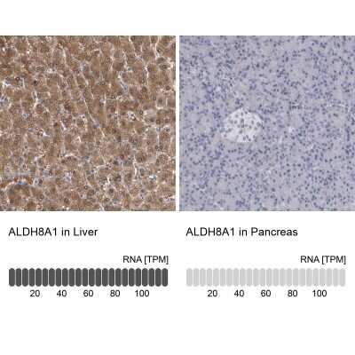 Immunohistochemistry-Paraffin: ALDH8A1 Antibody [NBP1-89151]
