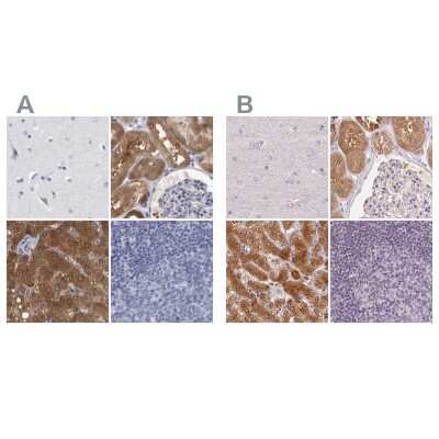 Immunohistochemistry-Paraffin: ALDH8A1 Antibody [NBP1-89151]