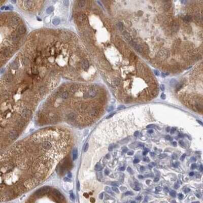 Immunohistochemistry-Paraffin: ALDH8A1 Antibody [NBP1-89151]