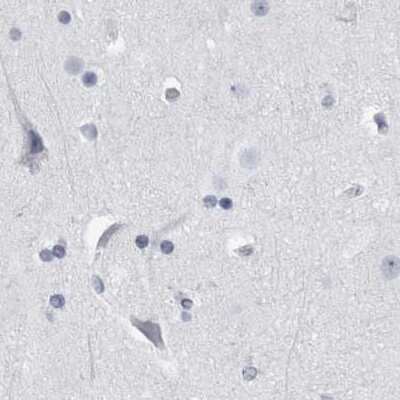 Immunohistochemistry-Paraffin: ALDH8A1 Antibody [NBP1-89151]